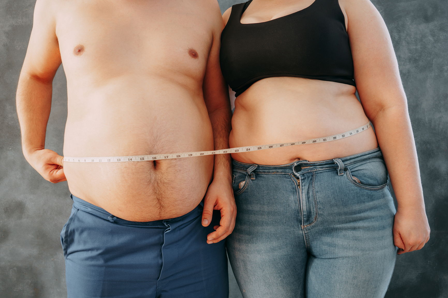 Абдоминальное ожирение у женщин фото